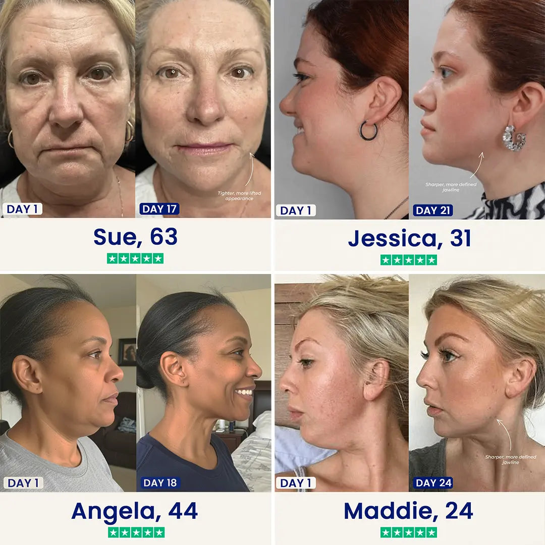 V-Line Mewing Band – Cooling Jawline Support & Pore Care