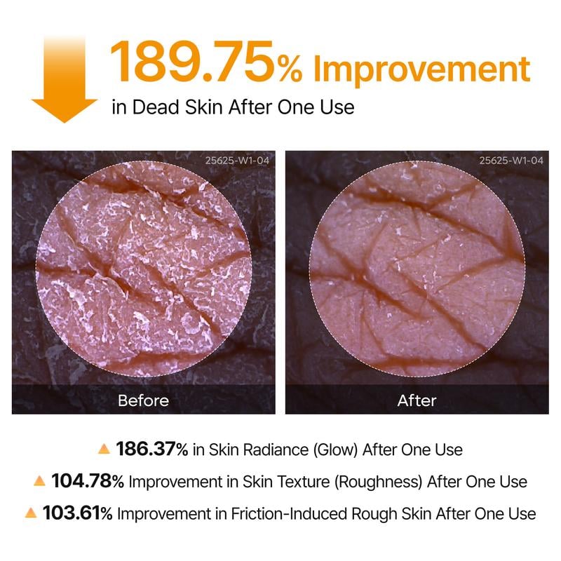 [Dr.Formtru]🌟Peel Shot Keratin Care Kojic Acid Turmeric Spray🌿 Gentle Peel, Even Tone, Spa Results