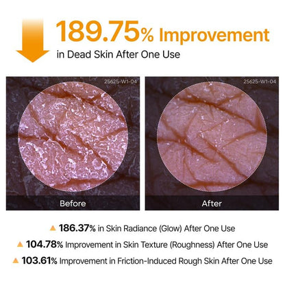 [Dr.Formtru]🌟Peel Shot Keratin Care Kojic Acid Turmeric Spray🌿 Gentle Peel, Even Tone, Spa Results