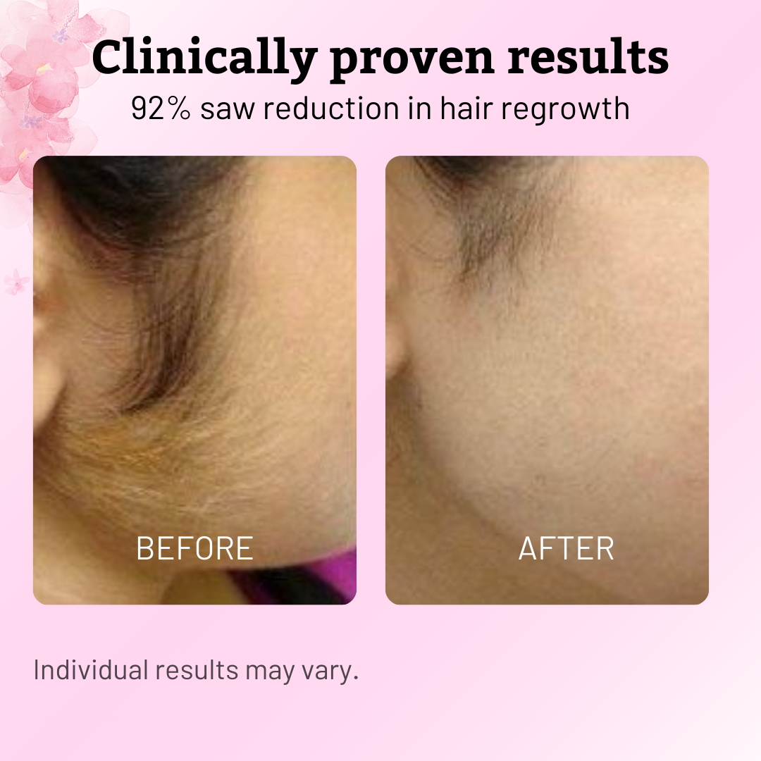 Natural Cyperus Rotundus Painless Hair Removal Oil ✨Permanent Smooth Skin
