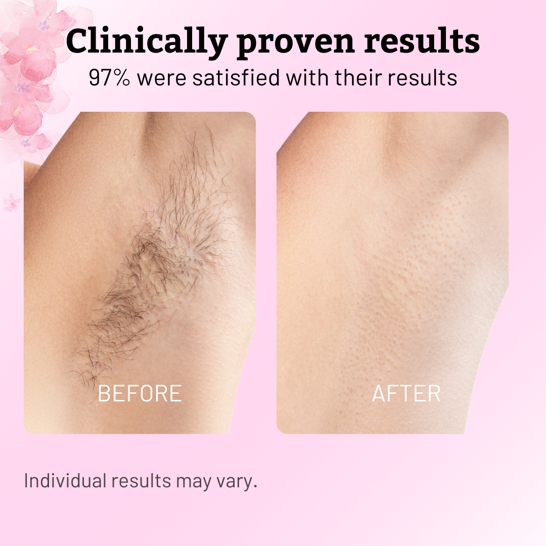 Natural Cyperus Rotundus Painless Hair Removal Oil ✨Permanent Smooth Skin
