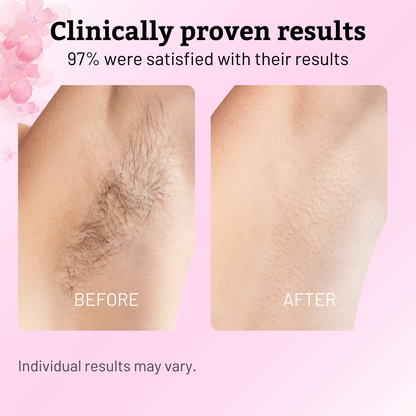 Natural Cyperus Rotundus Painless Hair Removal Oil ✨Permanent Smooth Skin