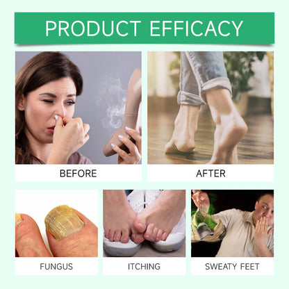 Tea Tree Oil Foot Spray 🌿 - Moisturizing Deodorant for Fresh Feet 🦶✨