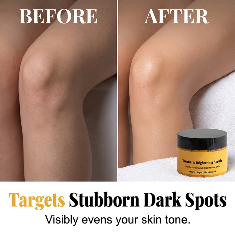 🔥Turmeric Exfoliating Body Scrub