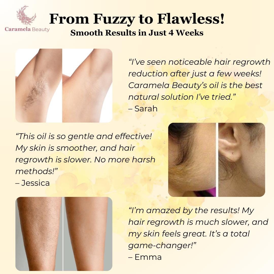 Natural Cyperus Rotundus Painless Hair Removal Oil ✨Permanent Smooth Skin