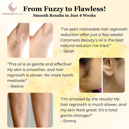 Natural Cyperus Rotundus Painless Hair Removal Oil ✨Permanent Smooth Skin